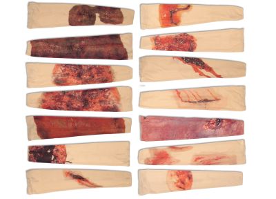 RAPID Trauma-Simulation